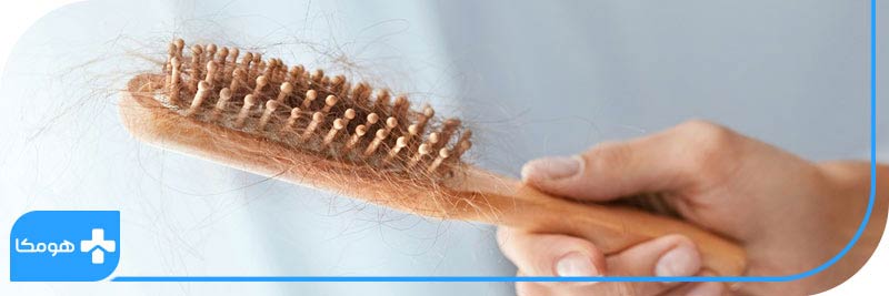 آیا آزمایشی برای تأیید ریزش مو وجود دارد؟ 